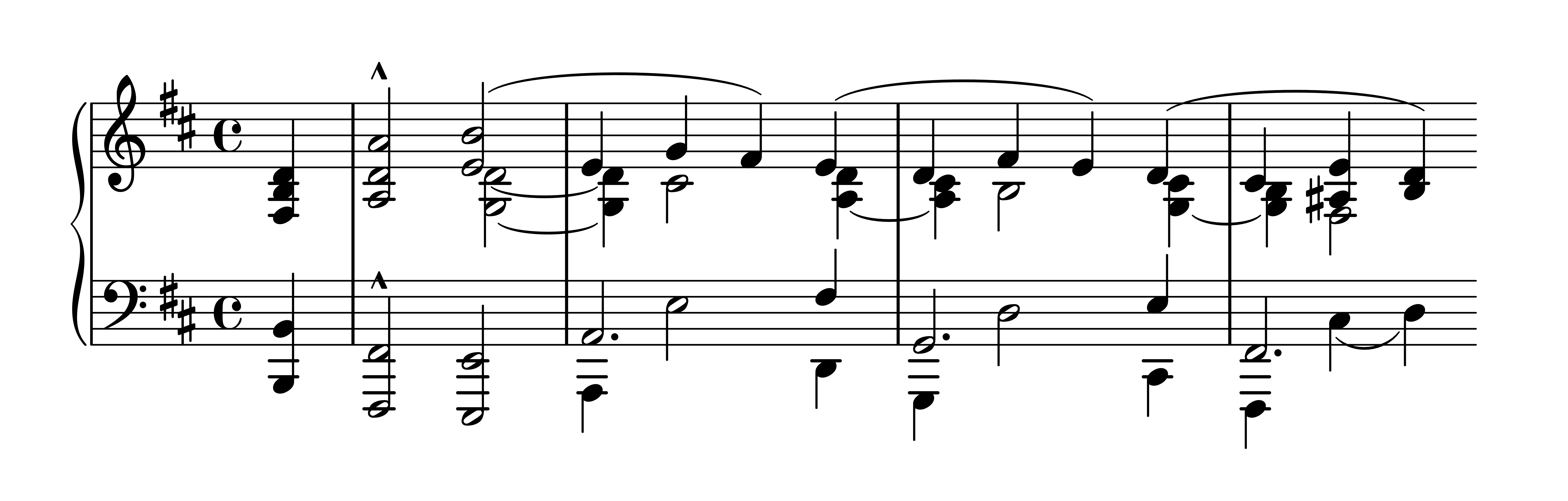 Es. 3: Robert Schumann, op. 133 n. 1, bb. 4-8