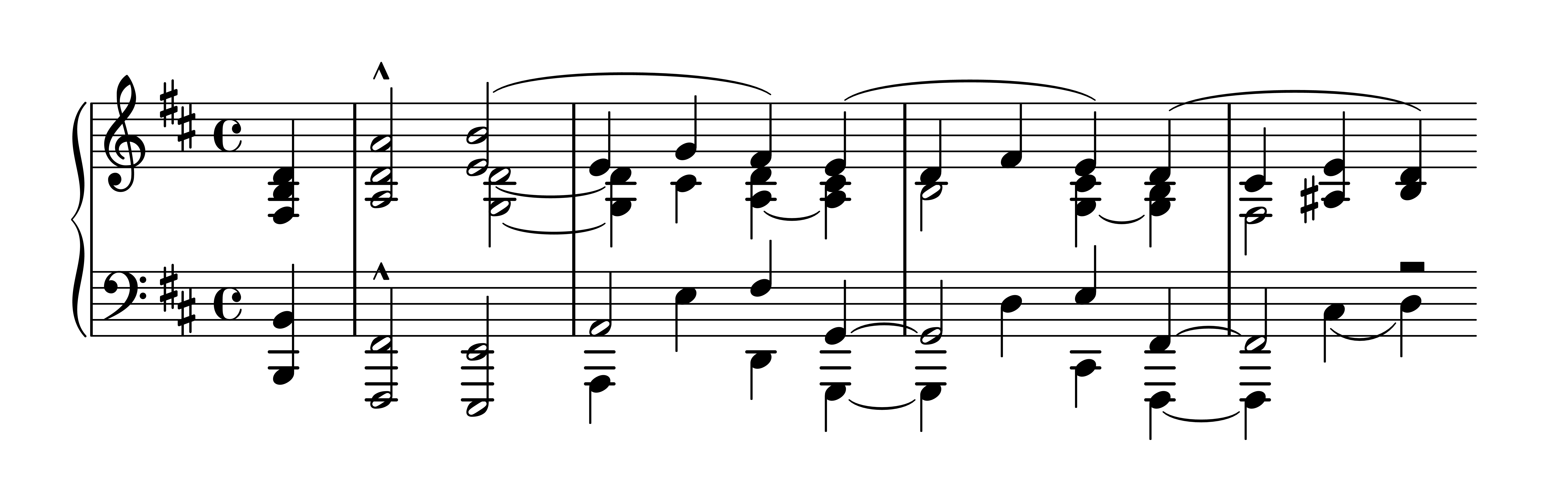 Es. 4: Robert Schumann, op. 133 n. 1, bb. 4-8 (con
              accompagnamento anticipato)