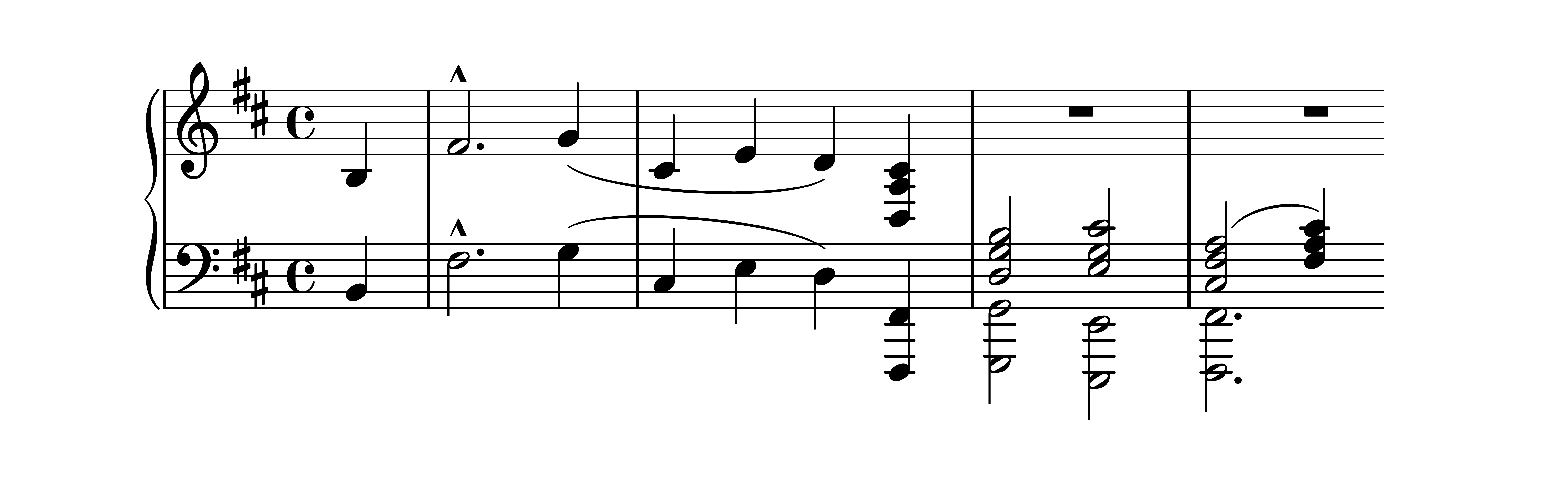 Es. 5: Robert Schumann, op. 133 n. 1, bb. 9-13