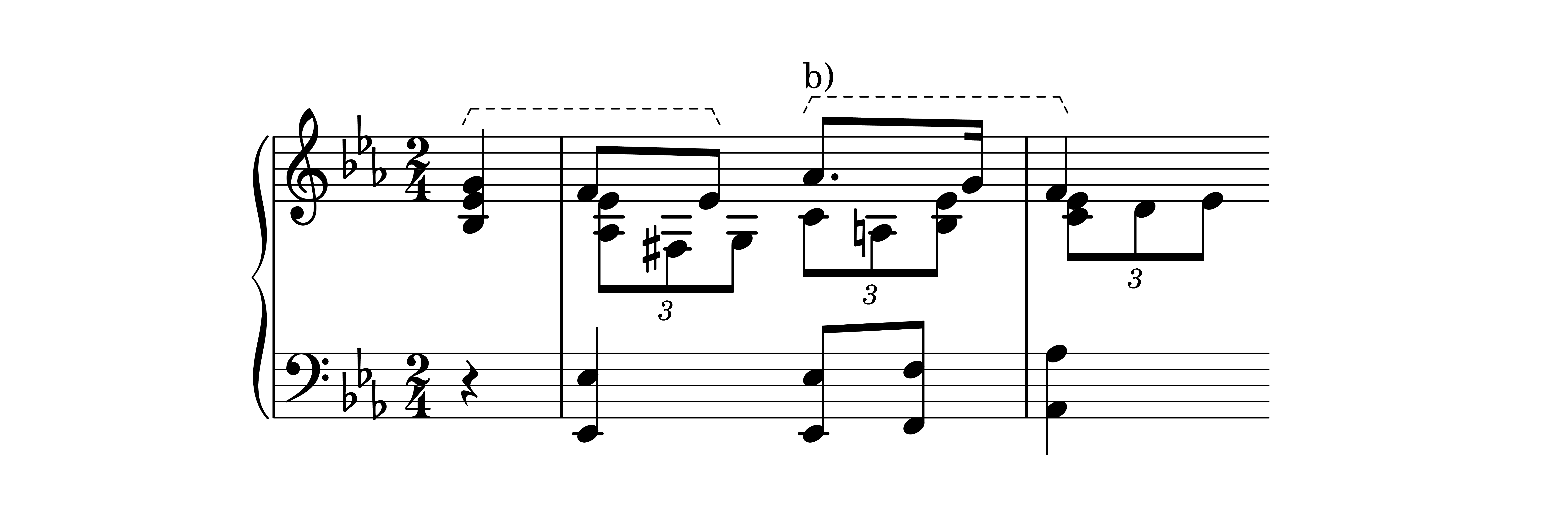 Es. 9: Robert Schumann, Variazione I, bb. 1-2