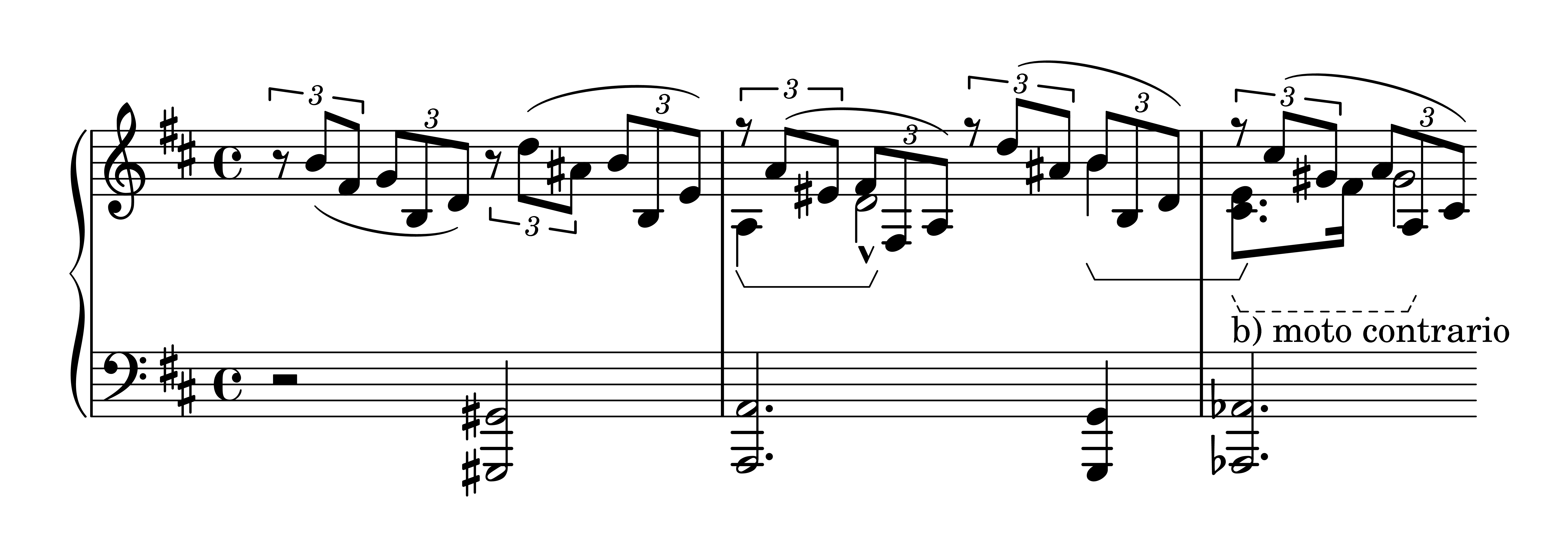 Es. 10: Robert Schumann, op. 133 n. 2, bb. 1-3